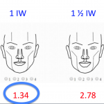 Lower Lip is Found to Be 1 iris width